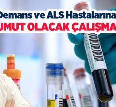 Doç. Dr. Özdemir’in Demans ve ALS Hastaları Çalışması,Nature Medicine dergisinde yayımlandı.