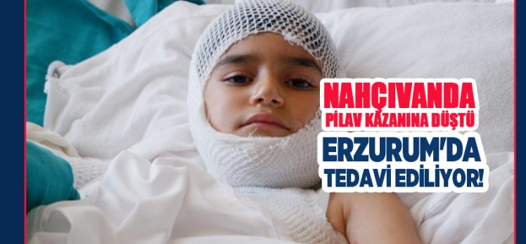 Pilav kazanına düşerek yanan Nahçıvanlı çocuk Erzurum Şehir Hastanesi’nde tedavi ediliyor!.. Pilav kazanına düşerek yanan Nahçıvanlı çocuk Erzurum Şehir Hastanesi’nde tedavi ediliyor!..